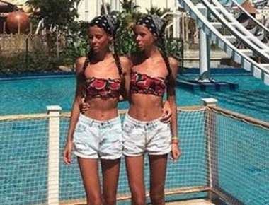 «Ζωντανά πτώματα»: Ενα βήμα πριν τον θάνατο δίδυμες αδερφές που πάσχουν από ανορεξία – Ζυγίζουν 36 και 40 κιλά (φώτο)